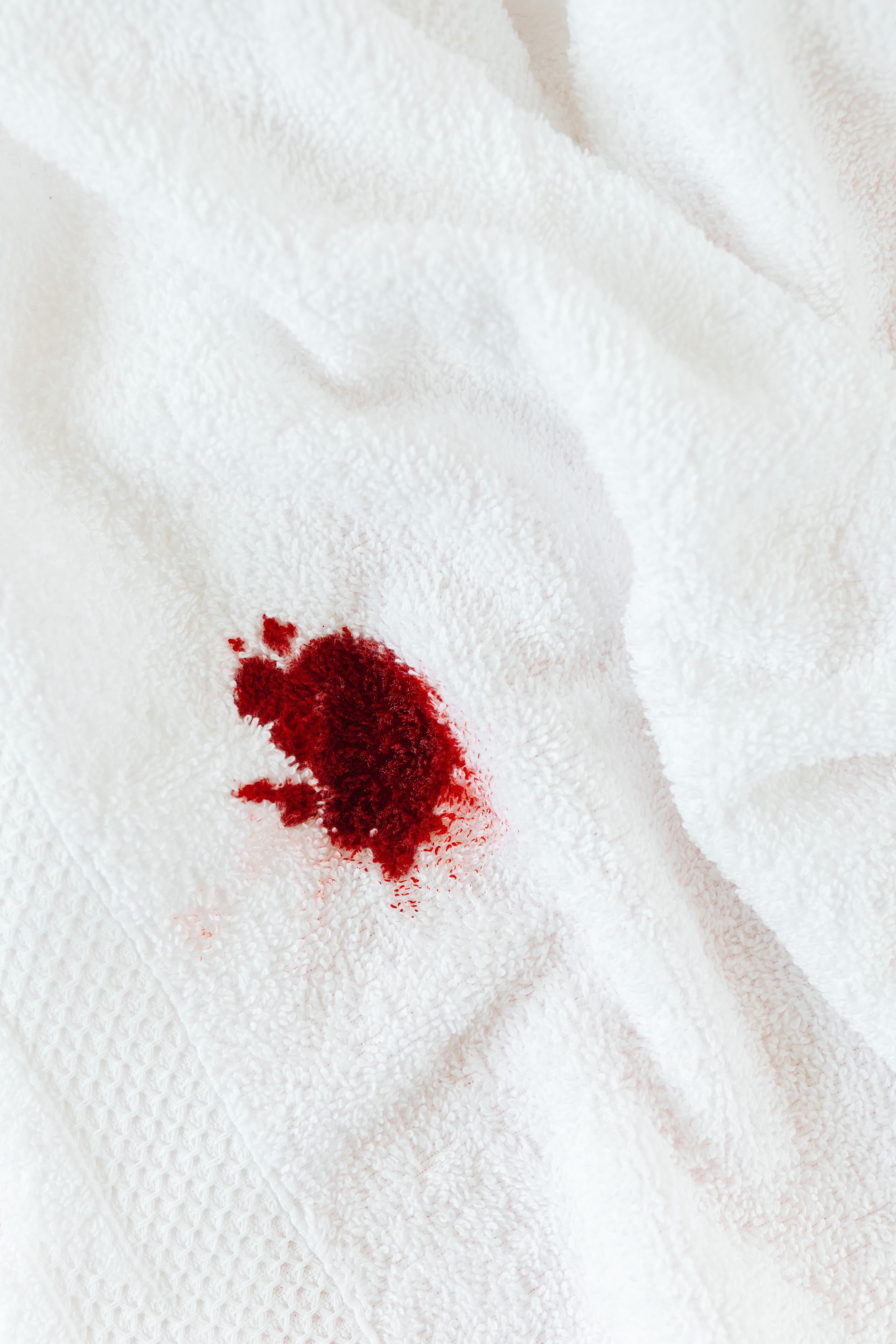 Close-up photo of a blood stain